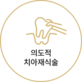의도적 치아재식술